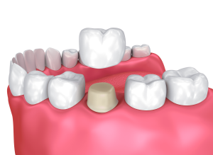 Rethinking Dental Health: The Role of Emotional Intelligence in Patient Care