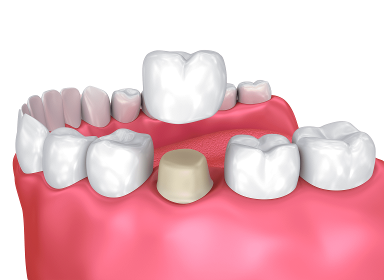 Rethinking Dental Health: The Role of Emotional Intelligence in Patient Care